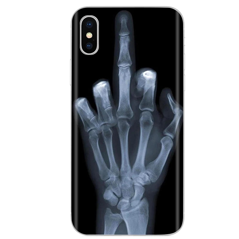 Cute Animal Flower Silicone Case for Iphone XR Case X Xs Max Simple Silicone Case for Iphone X Xs Max Xr Soft Cover Coque Shell